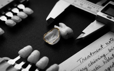 Veneers vs Whitening: Which Is Better for Your Smile Goals?